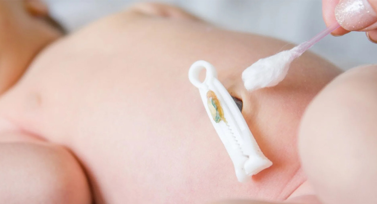 Signos de que tu bebé tiene el cordón umbilical infectado